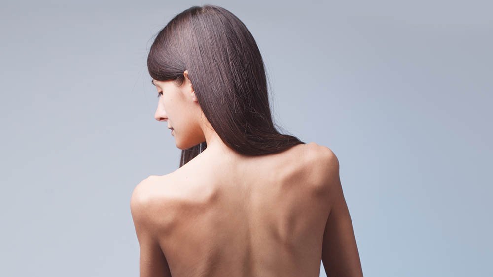 Saiba tudo sobre Anorexia Nervosa e quais os sintomas